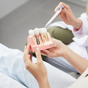 Установка имплантата Osstem, Dentium