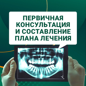 Составление плана лечения перед имплантацией