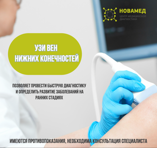 УЗИ вен ног