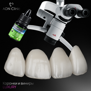 Керамика ADN Luxury Crown. Мировые стандарты качества