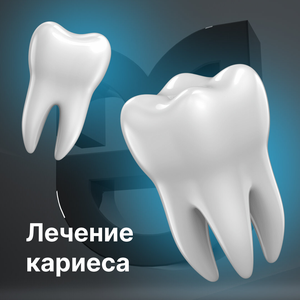 Лечение кариеса