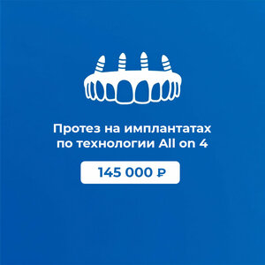 Протезирование на 4 имплантах Osstem