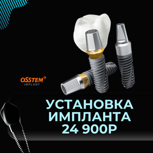 Установка Импланта Osstem 24 900 рублей