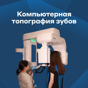 Компьютерная томография зубов
