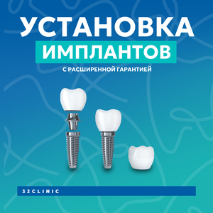 Имплантация зубов с расширенной гарантией.