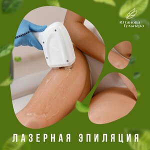 Лазерная эпиляция