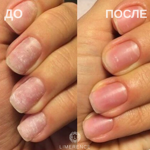 Маникюр