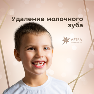 Операция удаления временного зуба