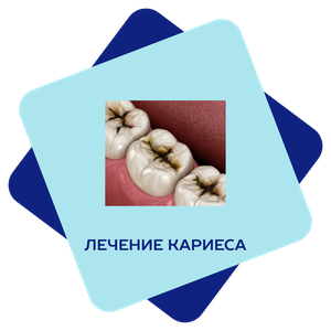Лечение зуба