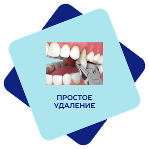 Простое удаление зуба