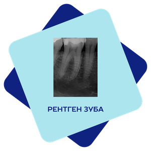 Рентген зуба 