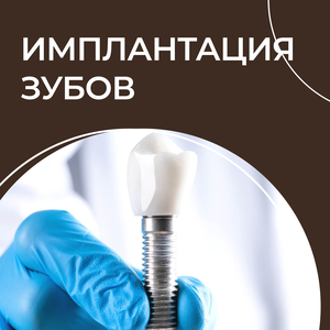 Имплантация зубов