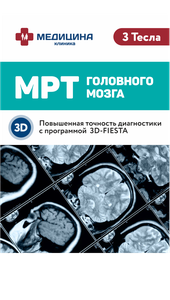 МРТ 3 Тесла головного мозга в режиме Fiesta в Махачкале!