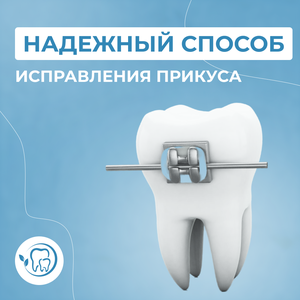 Брекеты