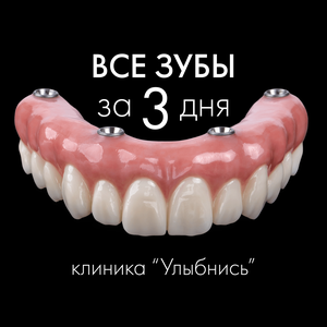 Все зубы на 4 имплантах за 3 дня!