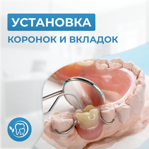 Протезирование