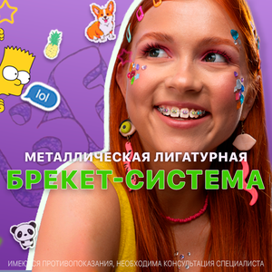 Брекет-система лигатурная