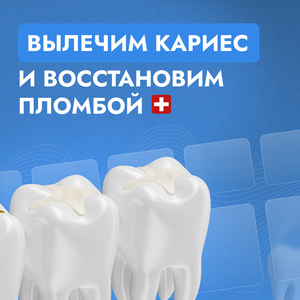 Лечение зубов
