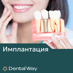 Имплантация