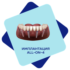 Имплантация ALL-ON-4