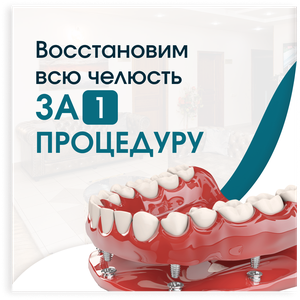 Имплантация челюсти «Все-на-4»