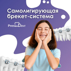 Лечение зубов на самолигирующей брекет-системе