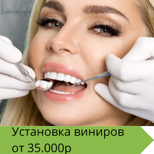 Виниры