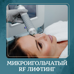 Микроигольчатый RF - лифтинг Vivace со скидкой 30%