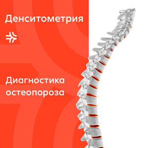 Денситометрия 