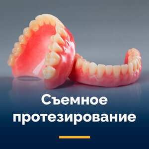 Протезирование