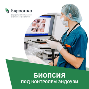 Биопсия под контролем эндоУЗИ