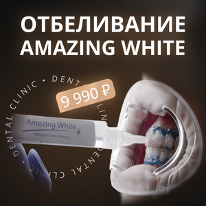Отбеливание зубов Amazing White