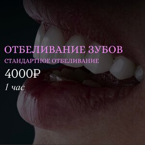 Стандартное косметическое отбеливание зубов