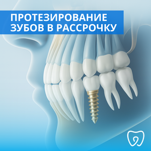 Протезирование зубов в рассрочку