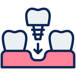 Имплантат DENTIUM (Южная Корея)