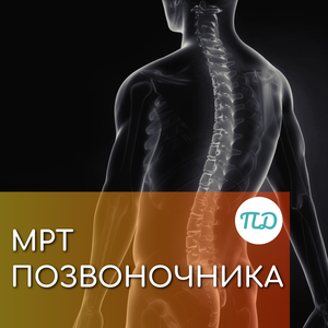 МРТ позвоночника
