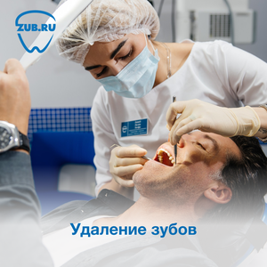 Удаление зубов