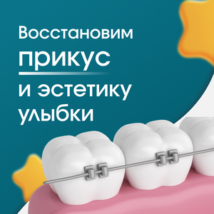 Установка брекетов