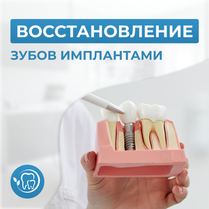 Имплантация