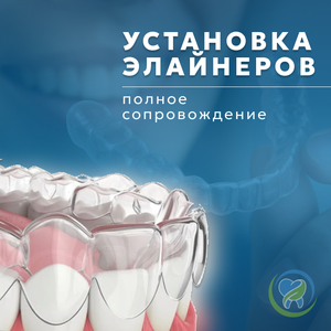 Элайнеры