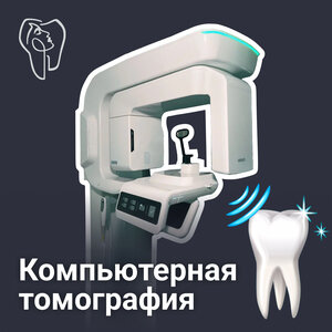Компьютерная томография