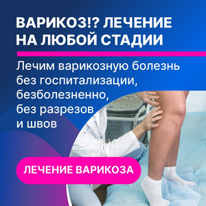 Лазерное лечение Варикоза на любой стадии