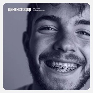 Металлические брекеты в рассрочку