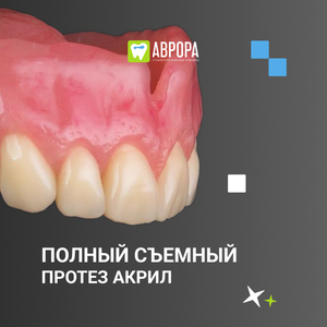 Полный съемный протез (акрил)
