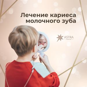 Восстановление молочного зуба композитной пломбой