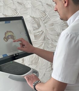 Интраоральное 3D-сканирование зубов