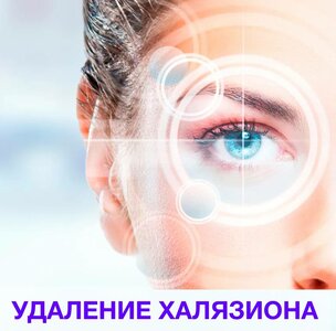 Удаление халязиона в клинике "Медицина 31"