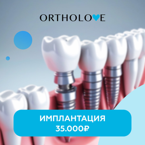 Имплантация зубов от 35.000₽