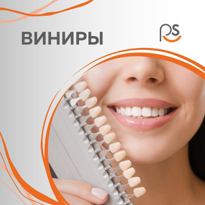 Установка виниров в PerfectSmile