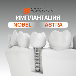 Имплантация (Nobel/Astra)